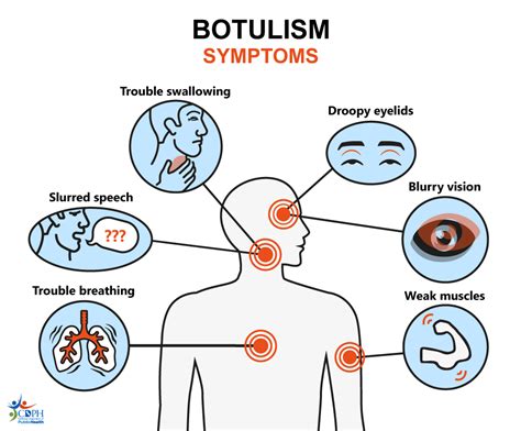 botulism symptoms in humans